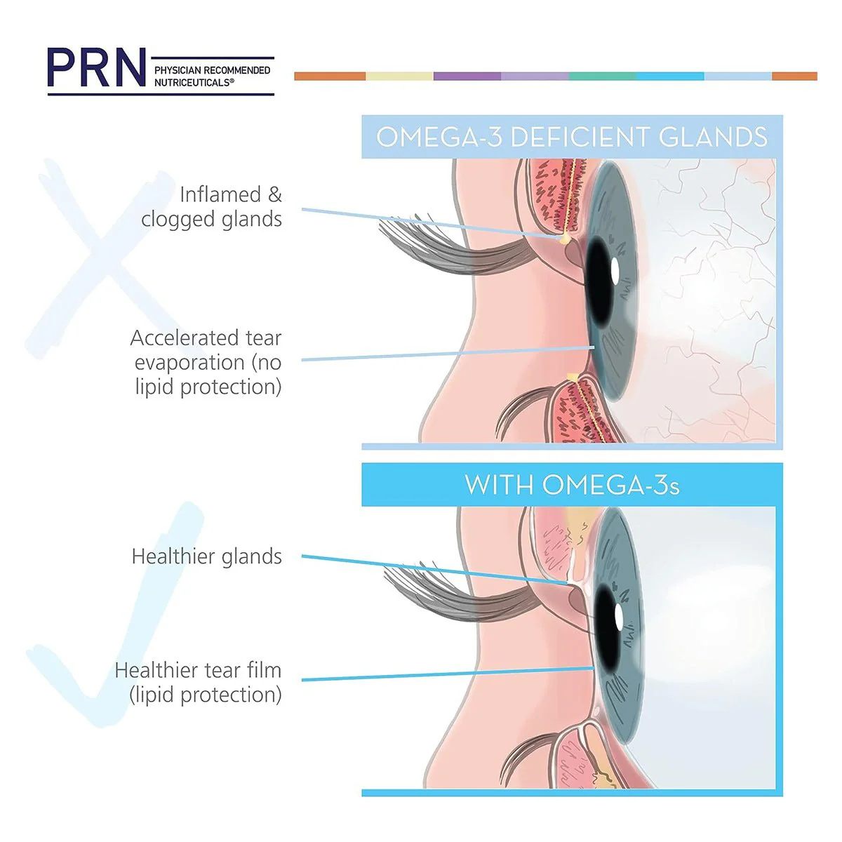PRN Dry Eye Omega BenefitsĀ® Liquid (1.3 and 2 month Sizes) - Image 4