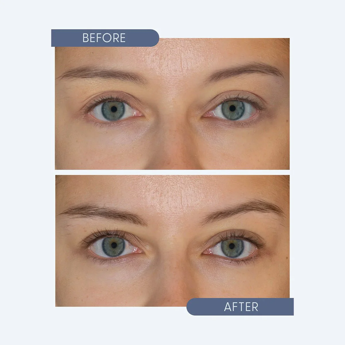 Twenty Twenty - Get Growing Lash & Brow Enhancing Serum (10ml Bottle) - Image 5