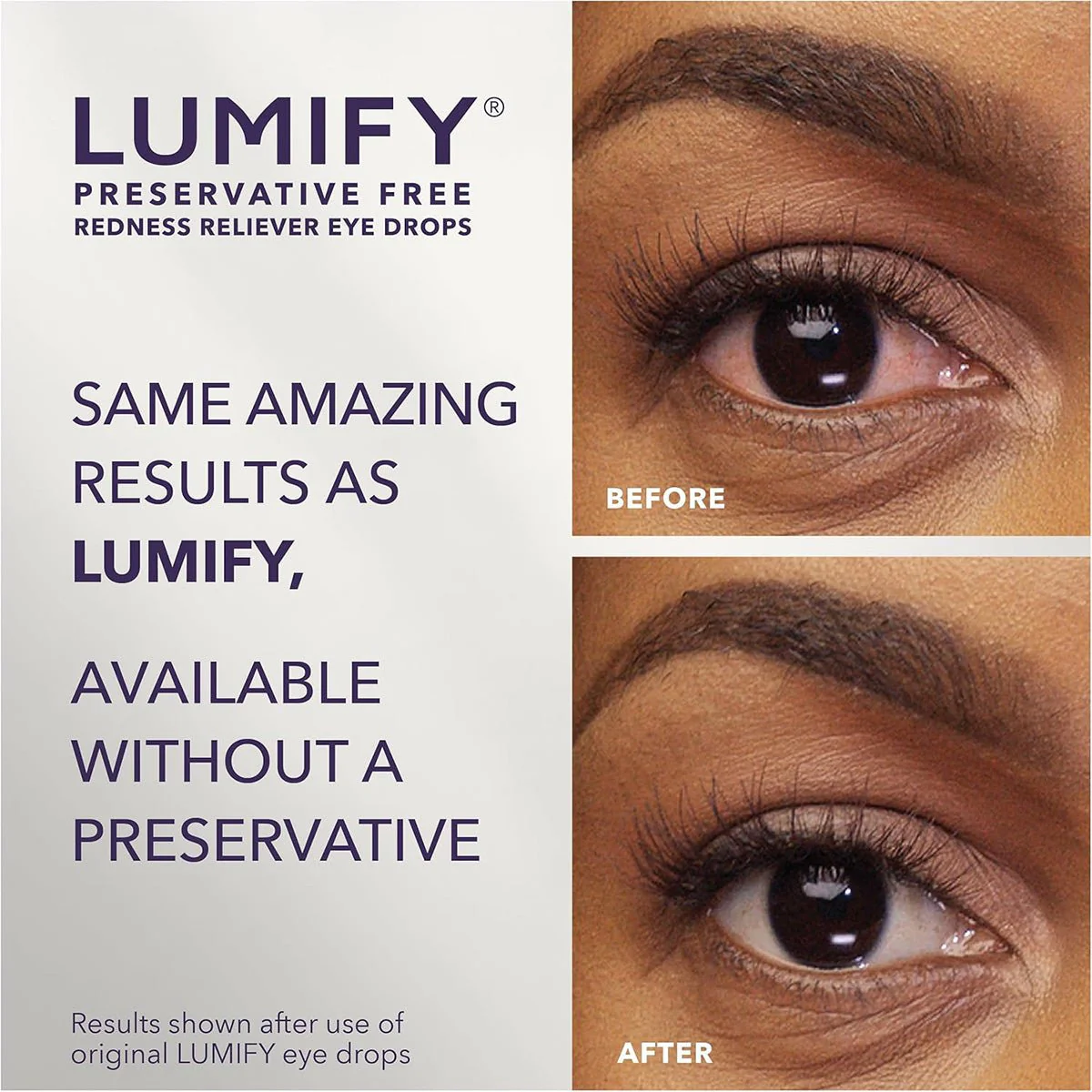 Lumify Preservative Free Redness Reliever Vials (20ct) - Image 6