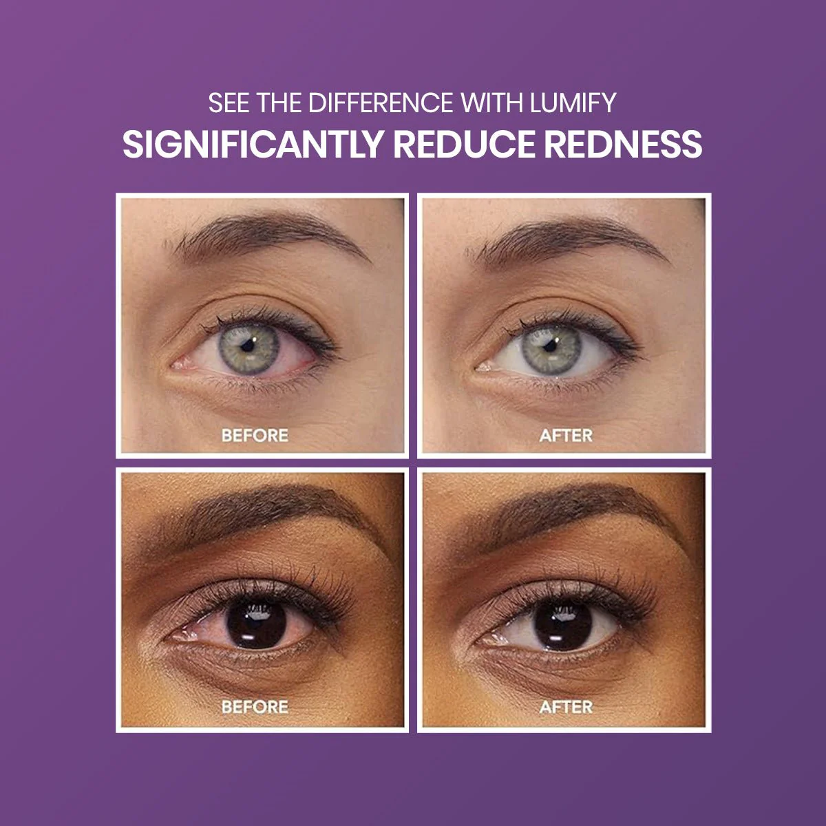Lumify Redness Reliever Twin Pack (7.5mL x 2) - Image 4