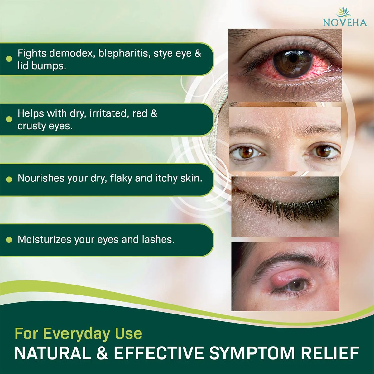 Noveha Demodex Eyelid Cleanser Foam, Extra Strength Tea Tree Oil Formula (100ml) - Image 3