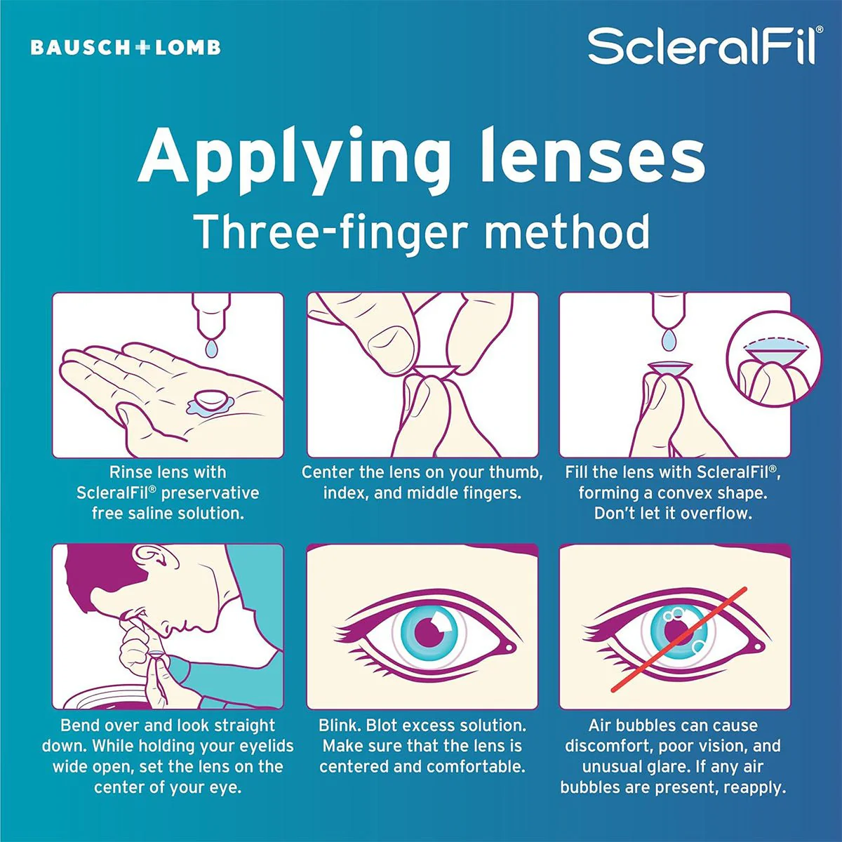 ScleralFil Preservative Free Saline Solution for Scleral, Soft, & Rigid Gas Permeable Lenses, Buffered Solution, Single-Use Vials, 0.34 Fl Oz (Pack of 30) - Image 4